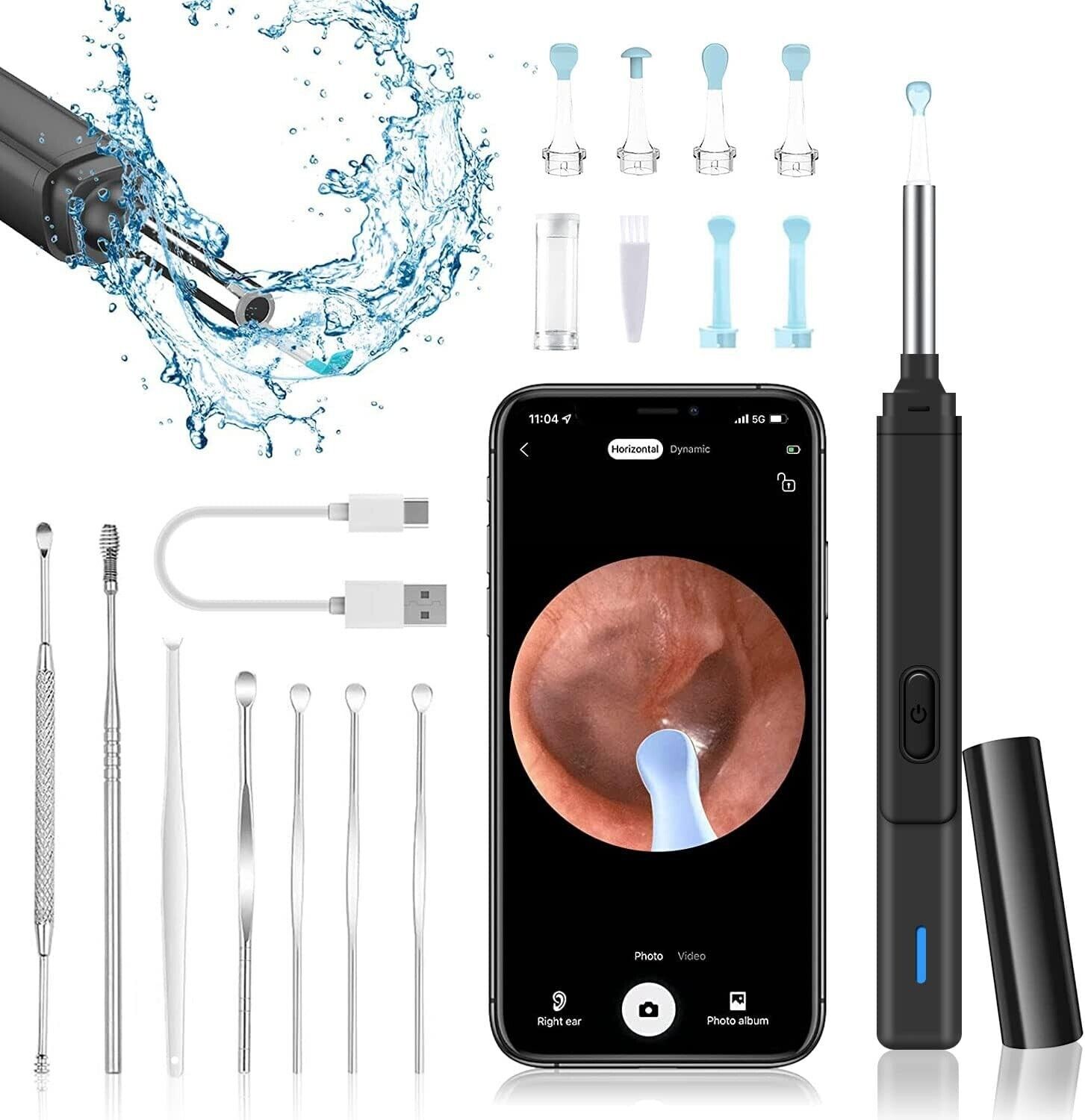 Fresion Smart Ear Wax Removal Kit Camera - 1080P HD Ear Cleaner\/Ear Wax Remover